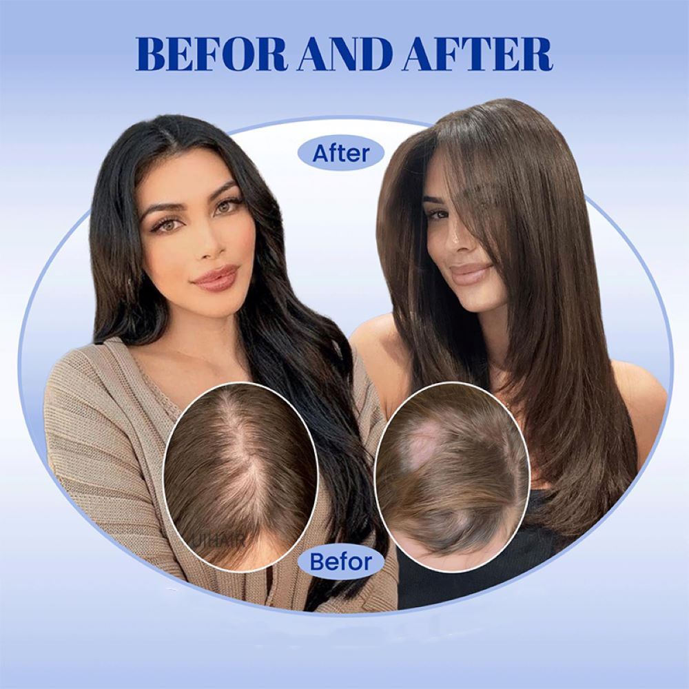 Blonde balayage silk topper for Caucasian hair textures