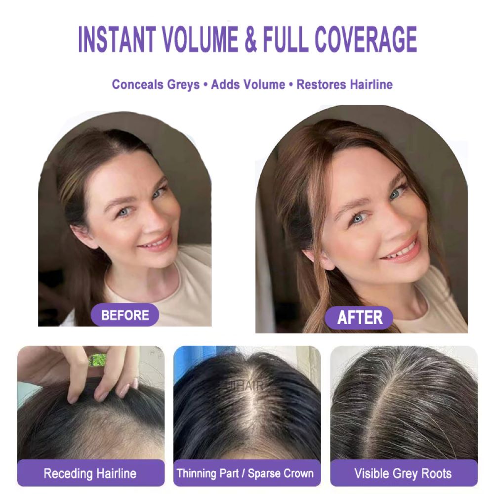 invisible scalp hair topper close shot